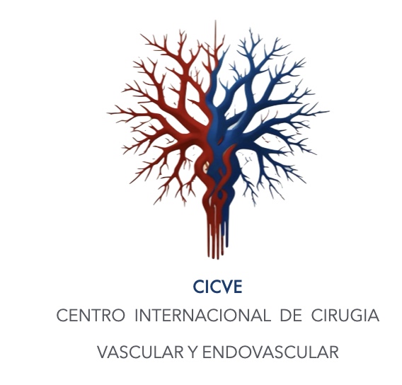 CICVE