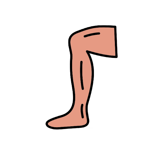 Cirugía Ambulatoria de Varices (Láser, Radiofrecuencia)
