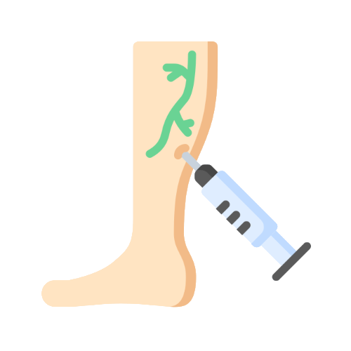 Tratamiento Estético de Varices (Escleroterapia)