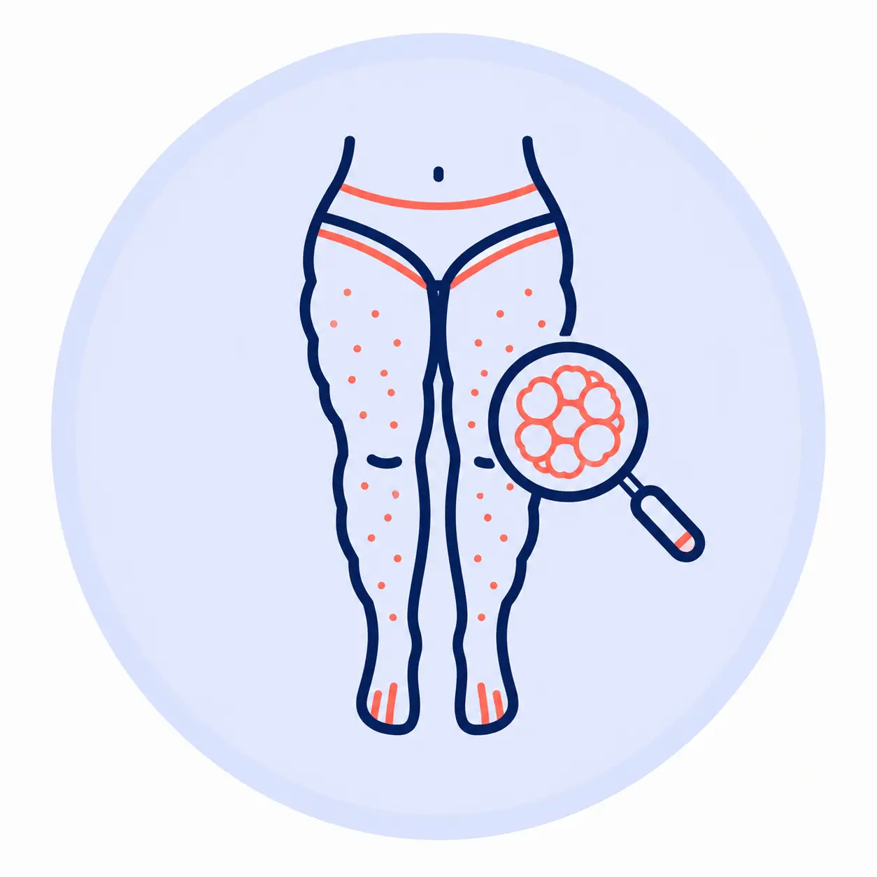 Tratamiento de Lipedema